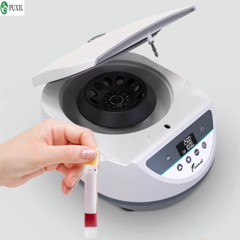 AB plasma centrifuge laborator - Blood Collection Tube recensione e prezzo