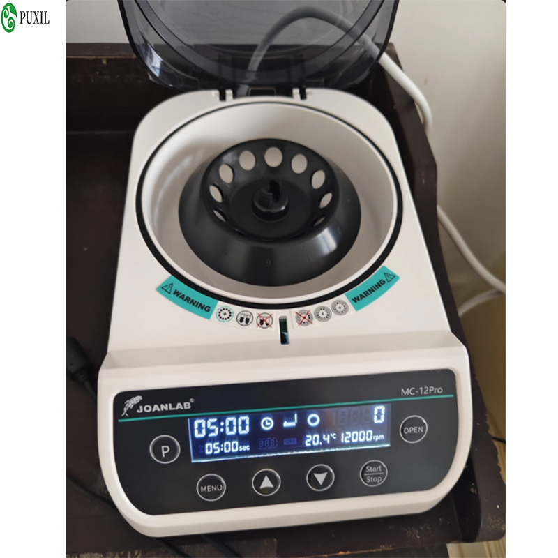 AB plasma centrifuge laborator - Blood Collection Tube recensione e prezzo