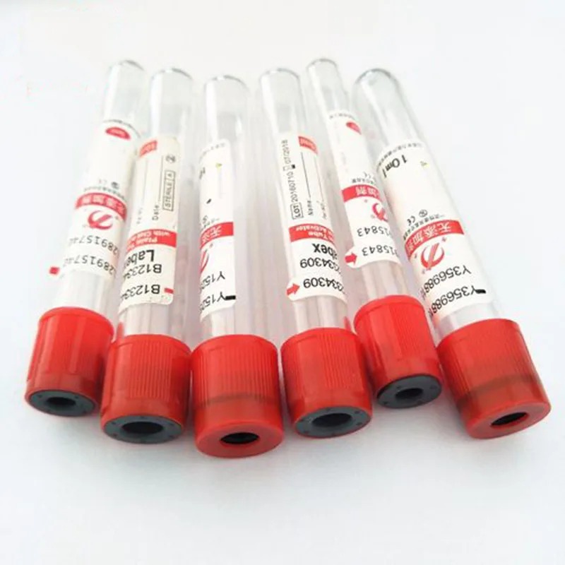 100pcs Disposable Vacuum Blood - Blood Collection Tube recensione e prezzo